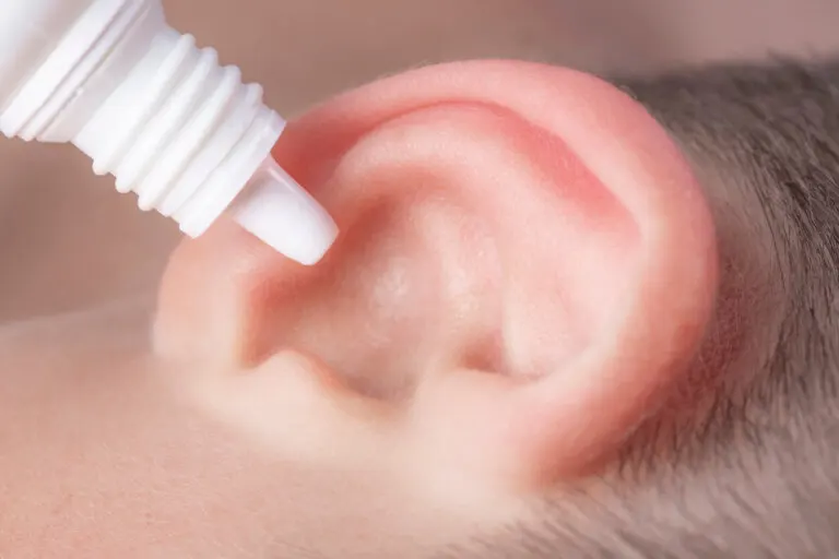 Pasos y cuidados para limpiar la cera de oídos con agua oxigenada